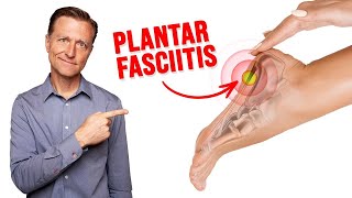 Fix Plantar Fasciitis Instantly NO MORE HEEL PAIN [upl. by Combe566]