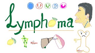 Lymphoma Introduction  Painless Enlarged Lymph Node  Hematology and Oncology Series [upl. by Neerual]