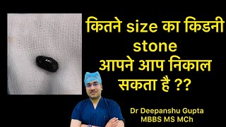 What Size kidney stone passes naturally Dr Deepanshu Gupta [upl. by Rossing]