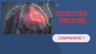 Comprendre la Fibrillation Auriculaire Explications et Exemples [upl. by Carter]