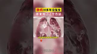 肺病30年没复发 原来是用了这个方法 中医 医学科普 chinesemedicine tcm shorts [upl. by Atiras]