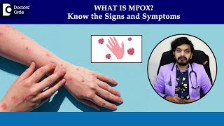 Monkeypox rash on skin  MPox Symptoms amp Diagnosis Mpox PhasesDrLeela Mohan P V RDoctors Circle [upl. by Manas]