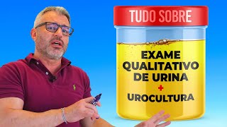 EXAME DE URINA tire todas suas dúvidas [upl. by Haldes]