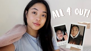 WISDOM TEETH REMOVAL  VLOG  SURGERY  RECOVERY [upl. by Addiego]