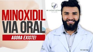 MINOXIDIL ORAL Tomar Minoxidil é melhor do que passar   Dr Lucas Fustinoni [upl. by Akcired]