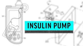 Implant Files Insulin Pump Explained [upl. by Anitnoc908]