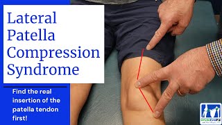 Lateral Patella Compression Syndrome LPCS [upl. by Annaiuq530]