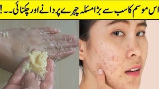 Apply This On Your FaceTo Remove Pimples Marks Dark Spot Skin Whitening Face Pack [upl. by Dloreh]