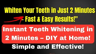 Whiten Your Teeth in Just 2 Minutes – Fast amp Easy Results [upl. by Ttsepmet]