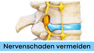 Nervenschaden nach Bandscheibenvorfall LWS [upl. by Charlena]