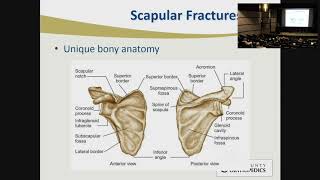 Clavicle and Scapula Fractures  Stephen Hunt MD [upl. by Anaira366]