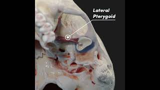 Temporomandibular joint TMJ and its articular disc [upl. by Hazel]