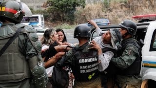 Joven detenido es herido a quemarropa por la GNB [upl. by Fan]