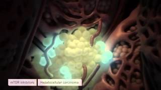 Medical Animation Liver Fibrosis and Cancer Oncology Animation [upl. by Sumahs]