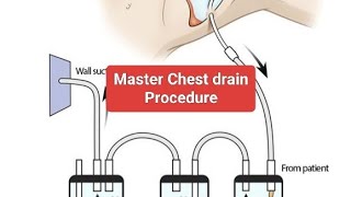 Chest drainage overview with aim steps procedure complications and aftercare [upl. by Keith]