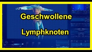 Geschwollene Lymphknoten  Vergrößerte Lymphknoten 2020 [upl. by Elreath]