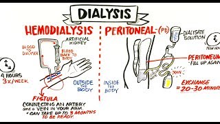 Failing Kidneys and Different Treatment Options [upl. by Aisetra188]