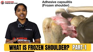 What is frozen shoulder   painful shoulder  shoulder stiffness [upl. by Hairehcaz]