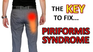 The KEY To Fix Piriformis Syndrome … For Good DON’T stretch it [upl. by Tubb55]