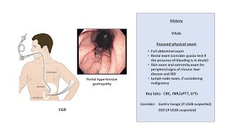 An Approach to GI Bleeding Melena Hematemesis Hematochezia [upl. by Shulock744]