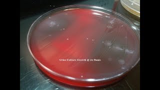 Urine Culture Colony Growth with Multiple Bacteria [upl. by Annaierb110]