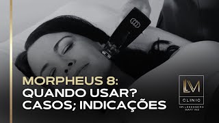 MORPHEUS 8 CONHEÇA SUA TECNOLOGIA [upl. by Irod367]