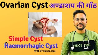 What is SIMPLE OVARIAN CYST amp HEMORRHAGIC OVARIAN CYST [upl. by Kathryn]