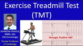 Exercise Treadmill Test TMT [upl. by Asyral]