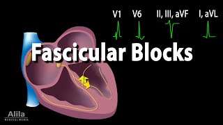 Fascicular Blocks Animation [upl. by Amled]