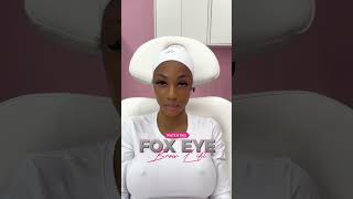 Fox eye thread lift Brow Lift using PDO Threads pdothreads browlift facelift [upl. by Nehemiah]