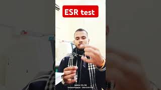 ESR test viralshort doctormedicallaboratorybloodtestlabmedicaltestmedicallaboratorytechnician [upl. by Sholom328]