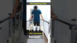 Physiotherapy sessions after Frame Removal  Tibia lengthening surgery [upl. by Namzed]