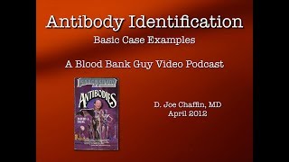 Antibody ID The Basics Part 1 [upl. by Nylsaj847]