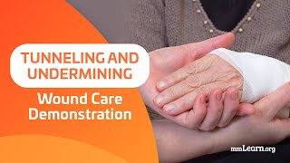 Tunneling and Undermining  Wound Care Demonstration [upl. by Euqinor]