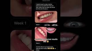 Makes You Go WOW 😁 wow lifestyle selfcare teethwhitening tiktok dentalcare smile beauty [upl. by Aioj]