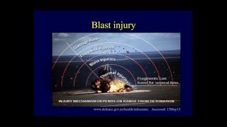 Orthopaedic blast injuries Blast wave mechanics and primary blast injury OTA lecture IV D01b [upl. by Bakemeier]