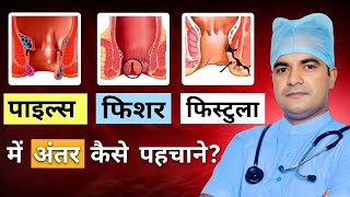 piles fissure fistula mein kya antar hai  piles fissure fistula  piles fissure fistula difference [upl. by Anemolif12]