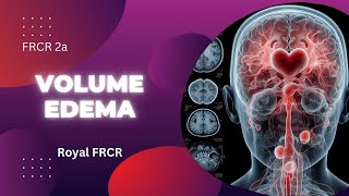 3  Neuroimaging for FRCR [upl. by Suivatna]