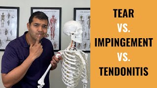 Rotator Cuff Tear VS Shoulder Impingement VS Shoulder Tendonitis [upl. by Aneekan944]