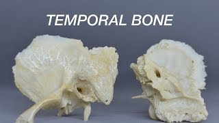 Osteology of Head amp Neck  Temporal Bone Anatomy mbbs bds education [upl. by Ueik]