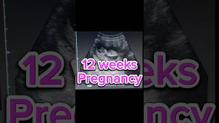 12 weeks Pregnancy scan  Anomaly Scan  Normal Obs  first strimester 1st [upl. by Chenee]