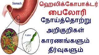 ஹெலிக்கோபாக்டர் பைலோரி நோய்த்தொற்று அறிகுறிகள் காரணங்களும் தீர்வுகளும்  Tamil health tips [upl. by Emee]