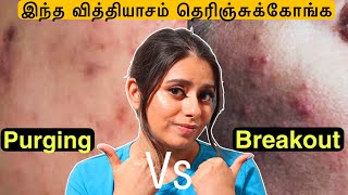 Know the differences between Breakout vs Purging  Irritation vs acne in Tamil [upl. by Rondi]