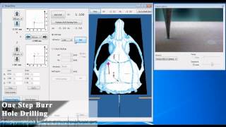 Neurostar  Drill amp Injection Robot [upl. by Reed]