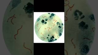 Streptococcus pyogenes [upl. by Tonya]