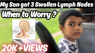 Lymph Nodes Behind Ear Swollen Lymph Nodes Behind Ear When to Worry Lump Behind Ear [upl. by Alleuqcaj]