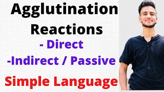 Agglutination Reaction Microbiology Agglutination Test [upl. by Josepha]