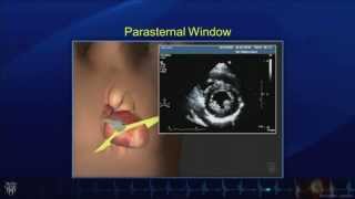 Echo Tutorial Comprehensive Transthoracic Echocardiogram  Mayo Clinic [upl. by Meadows300]