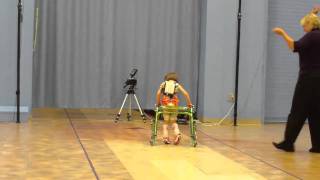 Gait Analysis CP Spastic Diplegia Part 3 [upl. by Gillespie]