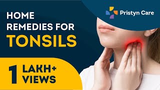 टॉन्सिलाइटिस का घरेलू उपचार  Home remedies for Tonsillitis [upl. by Elden]